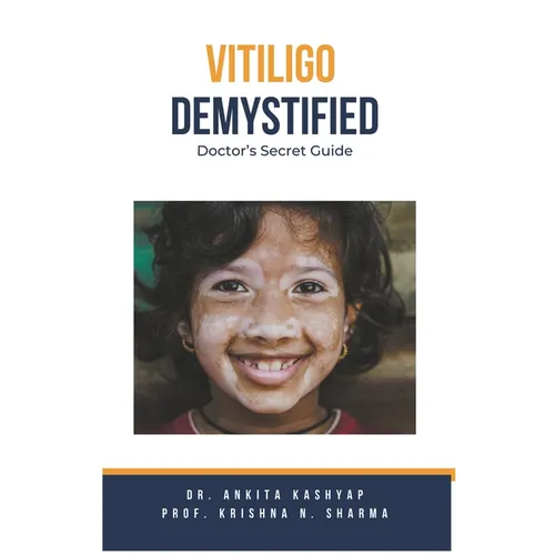 Vitiligo Demystified Doctors Secret Guide