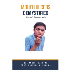 Mouth Ulcers Demystified: Doctor's Secret Guide