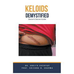 Keloids Demystified: Doctor's Secret Guide