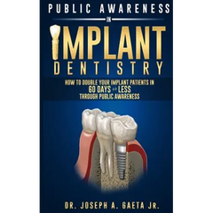 Public Awareness In Implant Dentistry: How To Double Your Implant Patients In 60 Days Or Less Through Public Awareness