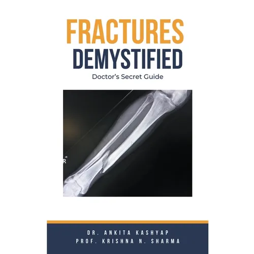 Fractures Demystified: Doctor's Secret Guide