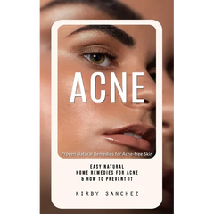 Acne: Proven Natural Remedies for Acne-free Skin (Easy Natural Home Remedies for Acne & How to Prevent It)